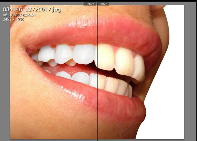 Отбеливание зубов в Lightroom Отбеливание зубов в Lightroom